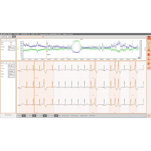 Cardioline Cubeholter software