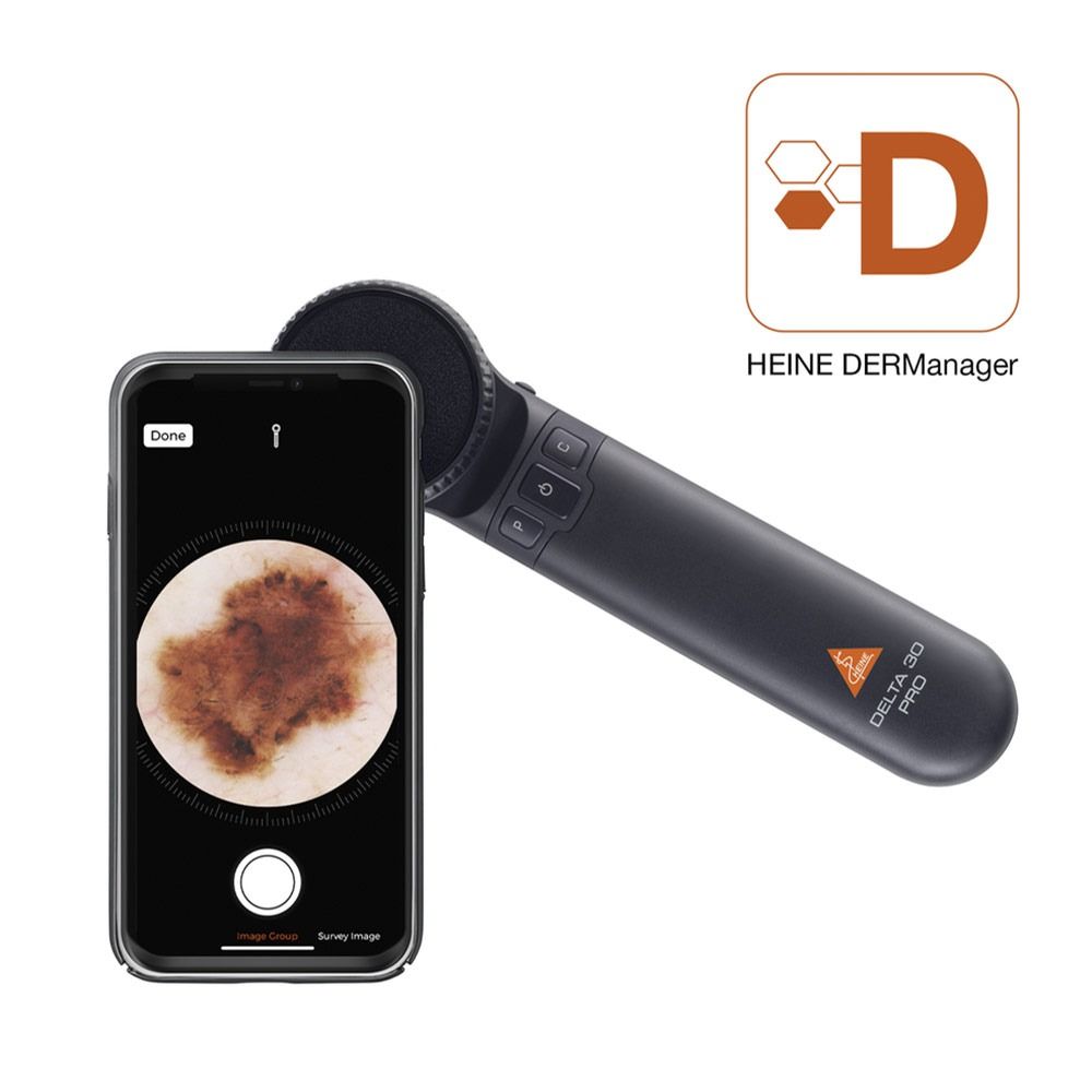 Heine Delta 30 Pro Bundle