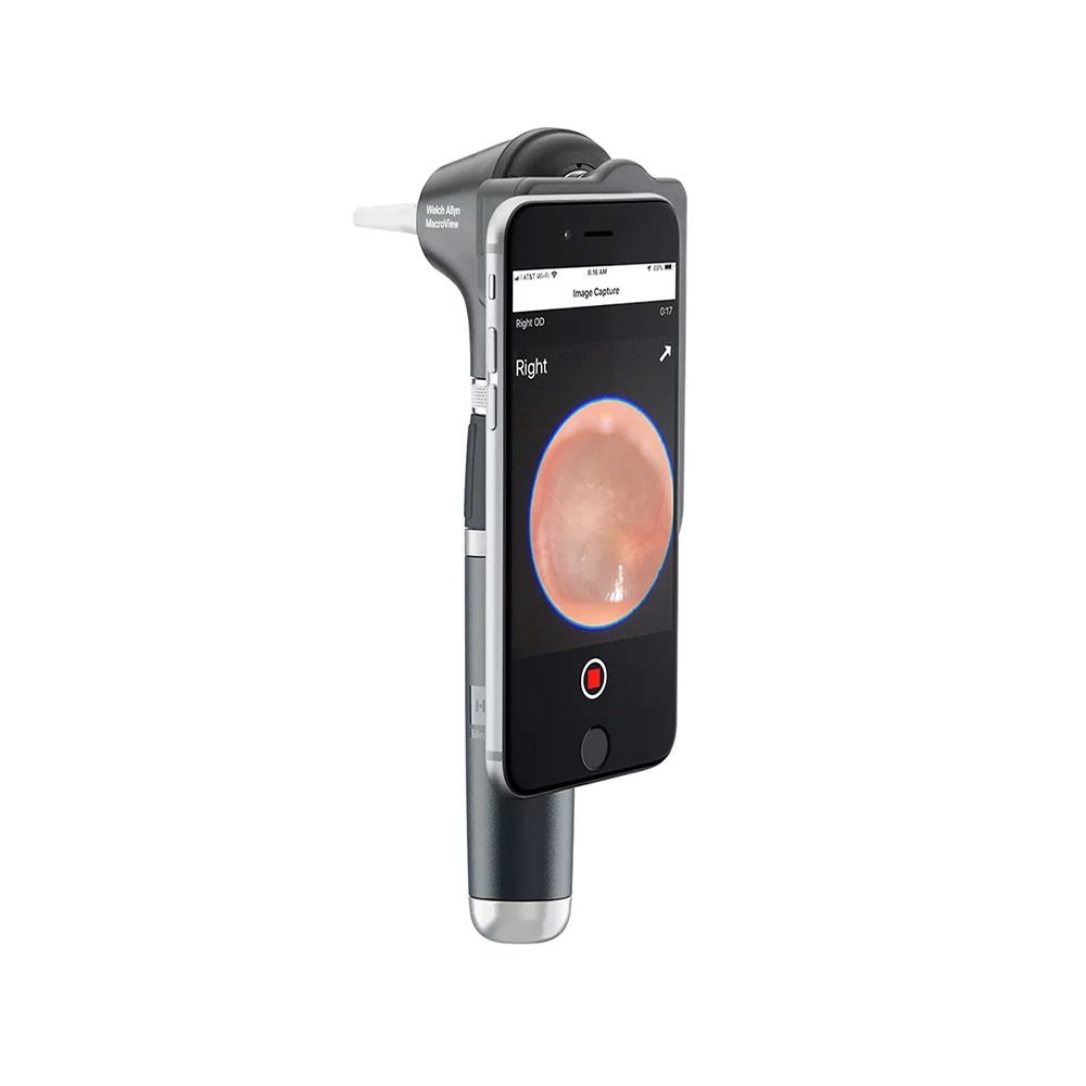 WA MacroView Plus otoscoop