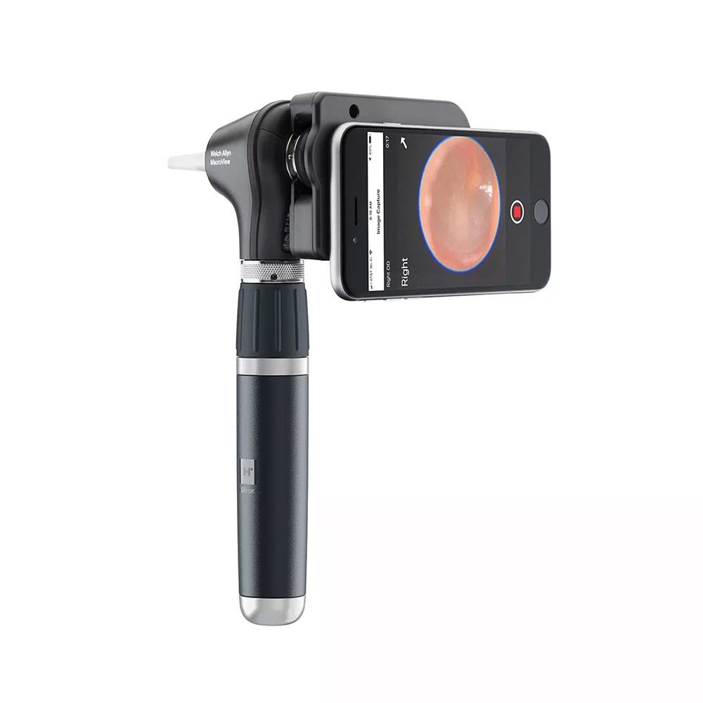 WA MacroView Plus otoscoop